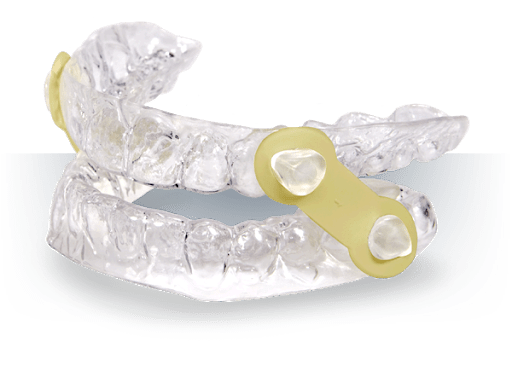 Sleep Apnea mouthpiece device at Princeton NJ